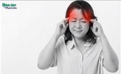 Chữa đau đầu bằng thuốc Nam: Phương pháp tự nhiên và hiệu quả