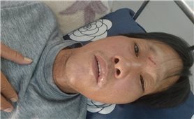 Kon Tum: Nhân viên bảo vệ rừng bị hành hung phải nhập viện điều trị