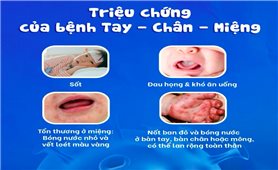 Khánh Hòa xuất hiện 21 ổ dịch tay chân miệng, tăng gấp 4 lần so với cùng kỳ