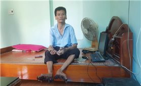 Nỗi niềm của người mắc bệnh “người cây” đầu tiên ở Việt Nam