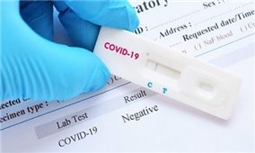 Bộ Y tế: Yêu cầu các doanh nghiệp báo cáo giá bán test xét nghiệm COVID-19