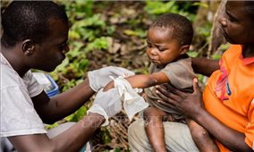 WHO kêu gọi đoàn kết toàn cầu ứng phó với bệnh đậu mùa khỉ