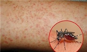 Khuyến cáo người dân không chủ quan với bệnh sốt xuất huyết