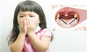 Cách phòng, tránh bệnh bạch hầu tốt nhất