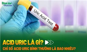 Nhận biết chỉ số Acid Uric bình thường - bất thường