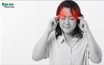 Chữa đau đầu bằng thuốc Nam: Phương pháp tự nhiên và hiệu quả