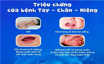Khánh Hòa xuất hiện 21 ổ dịch tay chân miệng, tăng gấp 4 lần so với cùng kỳ