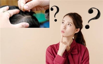 Bạn cần làm gì để ngăn ngừa tóc bạc sớm?