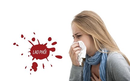 Bệnh lao phổi, hiểm họa khôn lường cần lưu ý