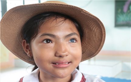 Chuyện về cô bé có đôi mắt hai màu kỳ lạ ở Đắk Lắk