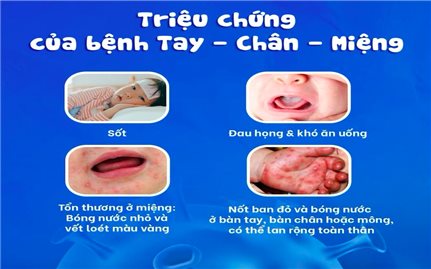 Khánh Hòa xuất hiện 21 ổ dịch tay chân miệng, tăng gấp 4 lần so với cùng kỳ