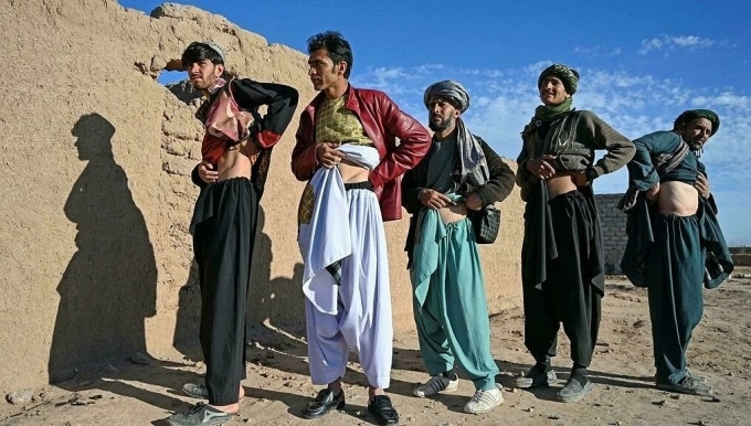 Ngày càng có nhiều người Afghanistan sẵn sàng bán nội tạng của mình để cứu gia đình khỏi chết đói. Ảnh: Wakil KOHSAR AFP