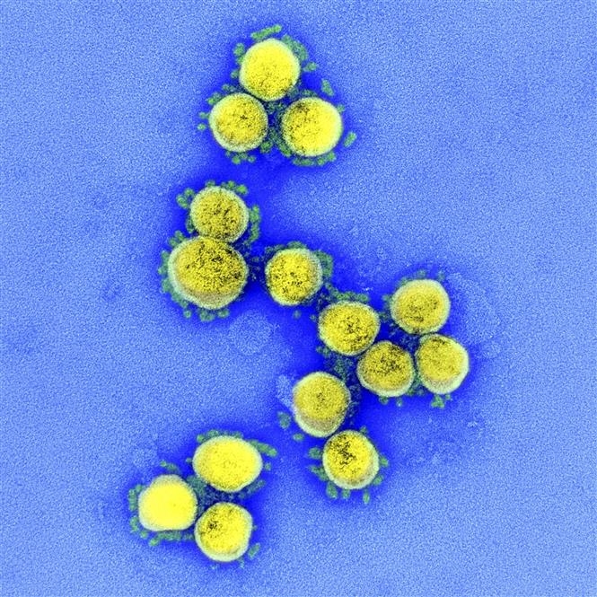 Hình ảnh từ kính hiển vi do Viện Y tế quốc gia Mỹ cung cấp cho thấy virus SARS-CoV-2 trong mẫu bệnh phẩm của bệnh nhân mắc COVID-19 ở Mỹ. Ảnh: AFP/TTXVN
