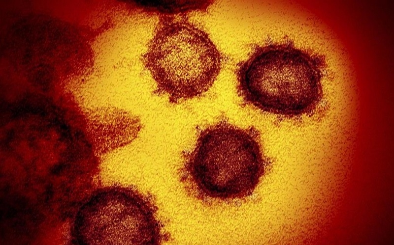 Hình ảnh dưới kính hiển vi do Viện Quốc gia về bệnh truyền nhiễm và dị ứng Mỹ cung cấp cho thấy, virus SARS-CoV-2 được phân lập và xuất hiện trên bề mặt tế bào của 1 bệnh nhân mắc Covid-19 tại Mỹ.