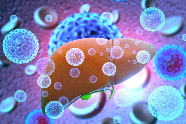 Hình minh họa 3D cho thấy lá gan bị nhiễm virus viêm gan. Ảnh: Handout