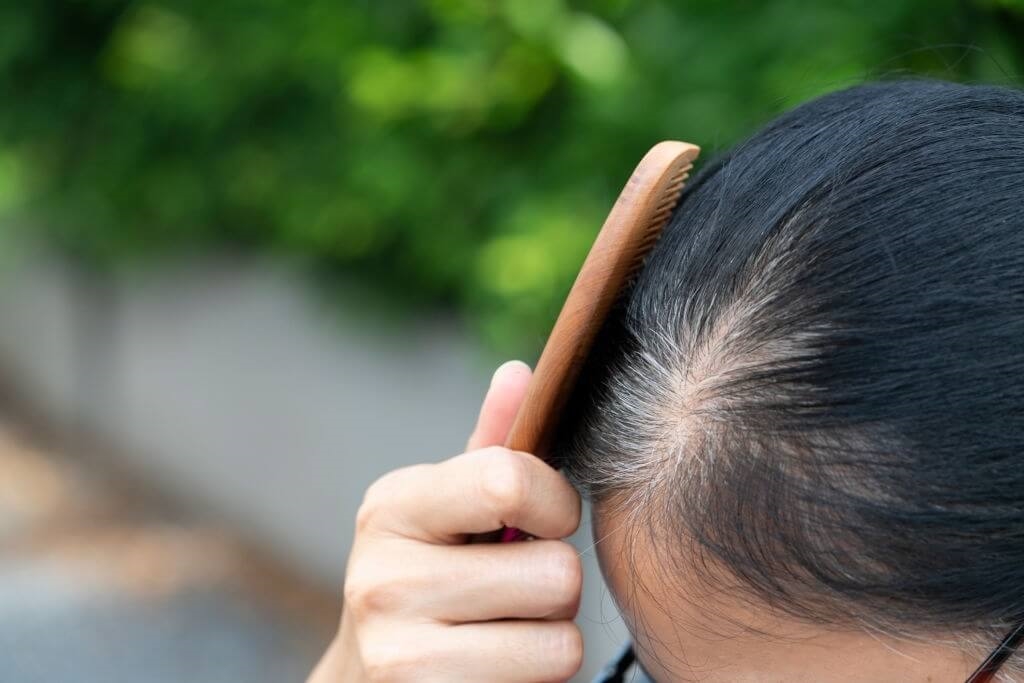 Cách trị tóc bạc sớm tại nhà bằng nguyên liệu thiên nhiên