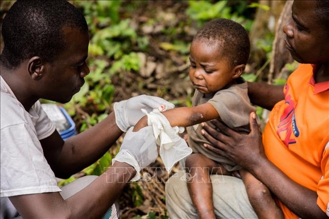 Nhân viên y tế điều trị cho em nhỏ mắc bệnh đậu mùa khỉ tại Zomea Kaka thuộc vùng Lobaya, CH Trung Phi. Ảnh tư liệu: AFP/TTXVN