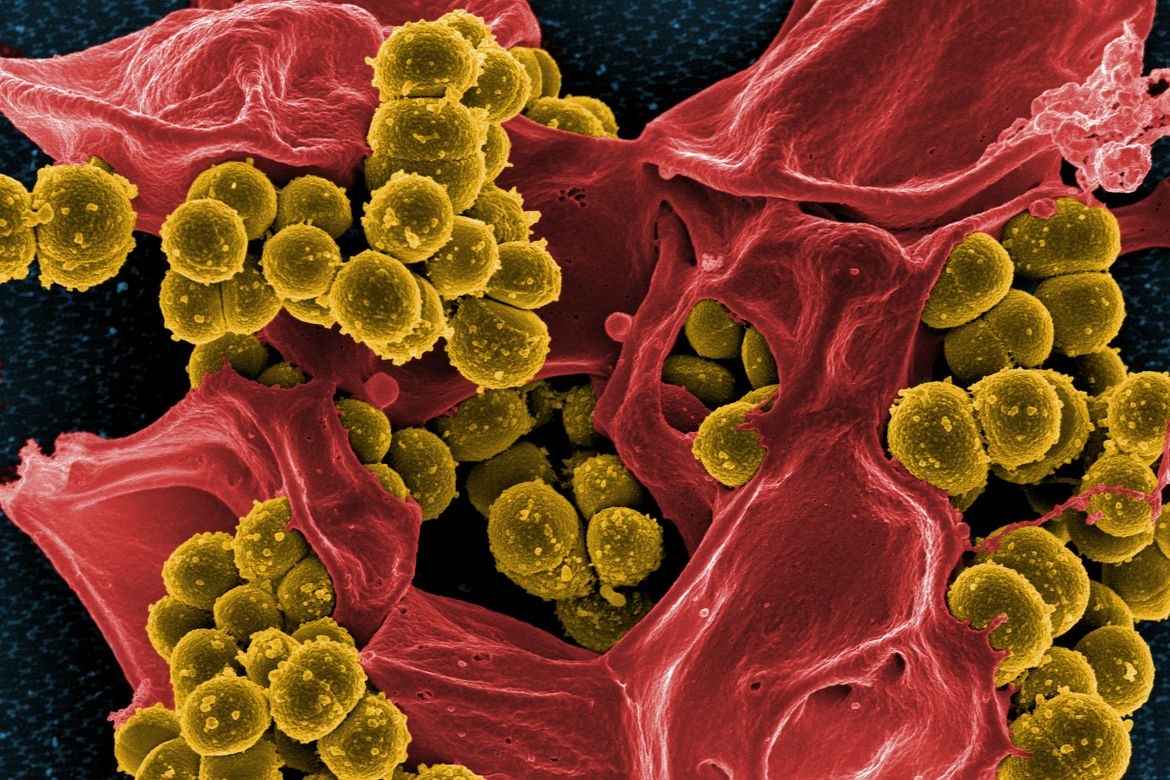 Hình ảnh chụp qua kính hiển vi điện tử vi khuẩn MRSA (màu vàng) ẩn trong tế bào bạch cầu của người. Ảnh: Universal Images Group/Getty Images
