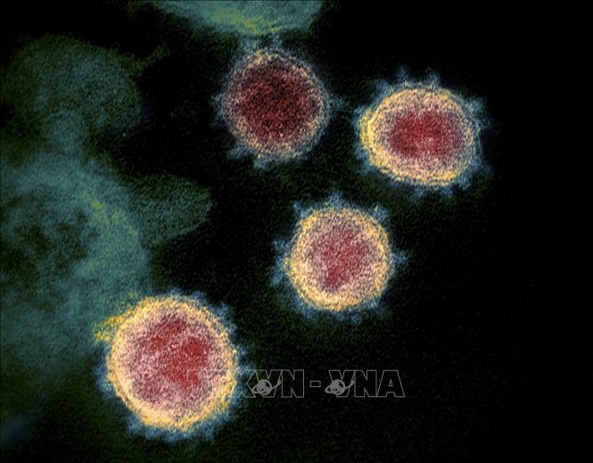 Hình ảnh từ kính hiển vi do Viện Y tế quốc gia Mỹ cung cấp cho thấy virus SARS-CoV-2 trong mẫu bệnh phẩm của bệnh nhân mắc COVID-19 ở Mỹ. Ảnh tư liệu: AFP/TTXVN