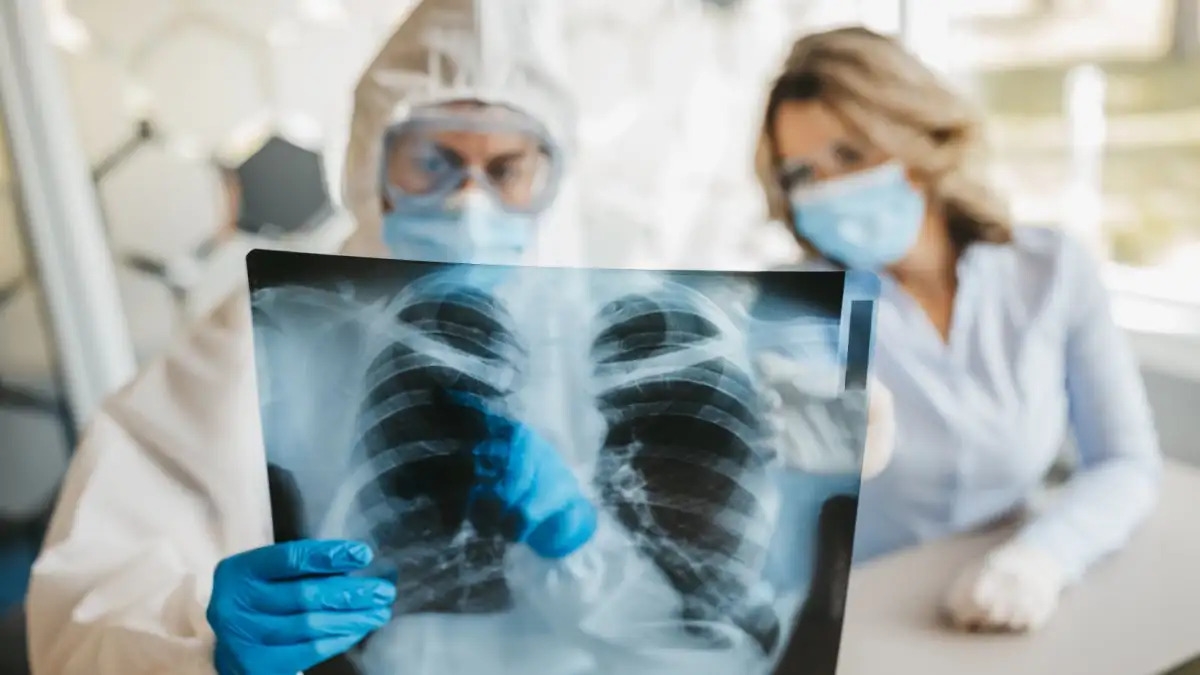 Chụp X quang để chẩn đoán người bị viêm phổi không rõ nguyên nhân tại tỉnh Tucumán, tây bắc Argentina