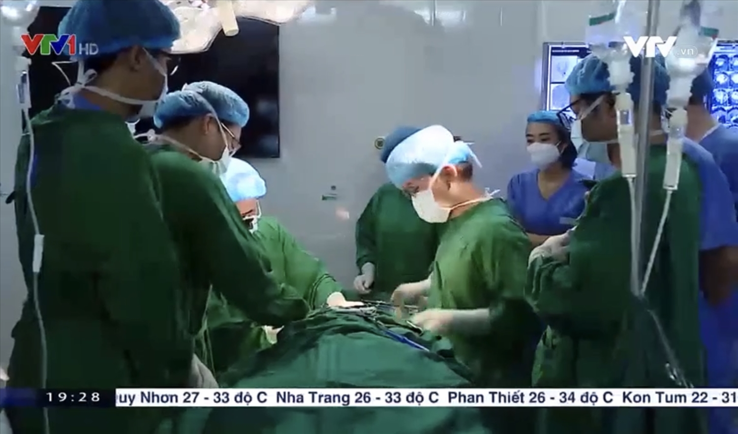 Các bác sĩ thực hiện phẫu thuật cho bệnh nhân - Ảnh VTV