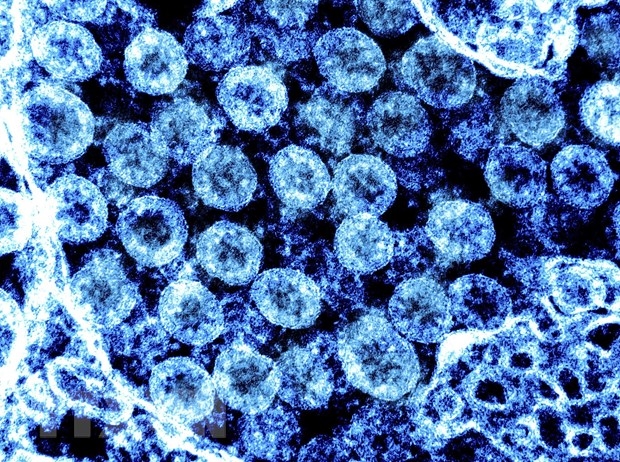 Hình ảnh từ kính hiển vi virus SARS-CoV-2 trong mẫu bệnh phẩm của bệnh nhân mắc COVID-19. (Ảnh: AFP/TTXVN)