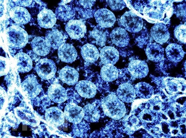 Hình ảnh từ kính hiển vi do Viện nghiên cứu bệnh truyền nhiễm và dị ứng quốc gia Mỹ cung cấp cho thấy các phần tử virus SARS-CoV-2 trong mẫu bệnh phẩm của bệnh nhân mắc COVID-19. (Ảnh: AFP/TTXVN)