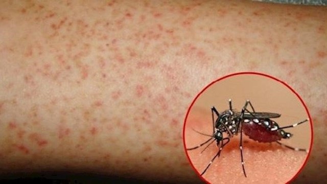 Muỗi gây bệnh sốt xuất huyết ngày càng có sức sống dai dẳng hơn
