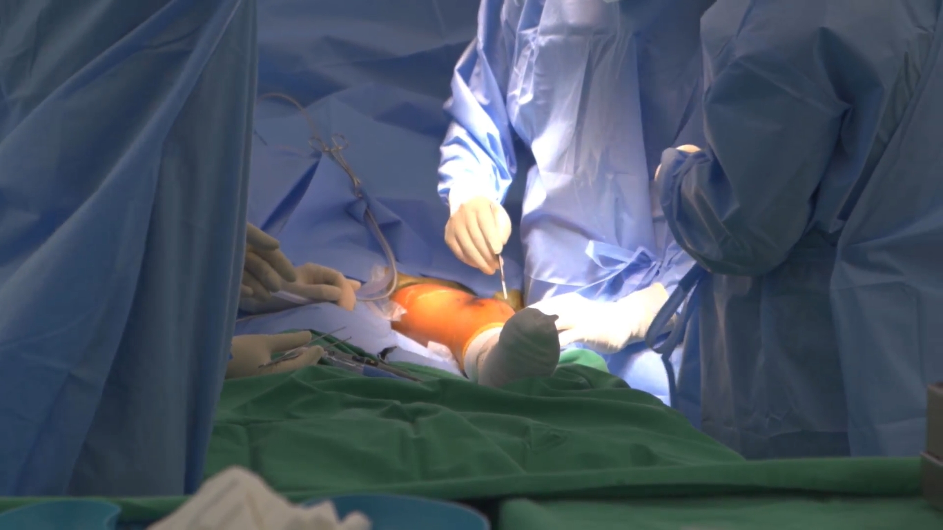 Bệnh nhân ung thư xương đầu tiên tại Việt Nam được phẫu thuật bảo tồn chi thay khớp tăng trưởng
