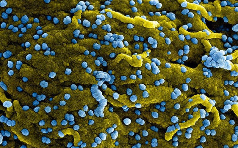 Virus Marburg (màu xanh lam), vừa sinh sôi và gắn trên bề mặt của các tế bào bị nhiễm bệnh (màu vàng).