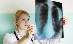 (Tổng hợp) Bệnh lao phổi, hiểm họa khôn lường cần lưu ý 5