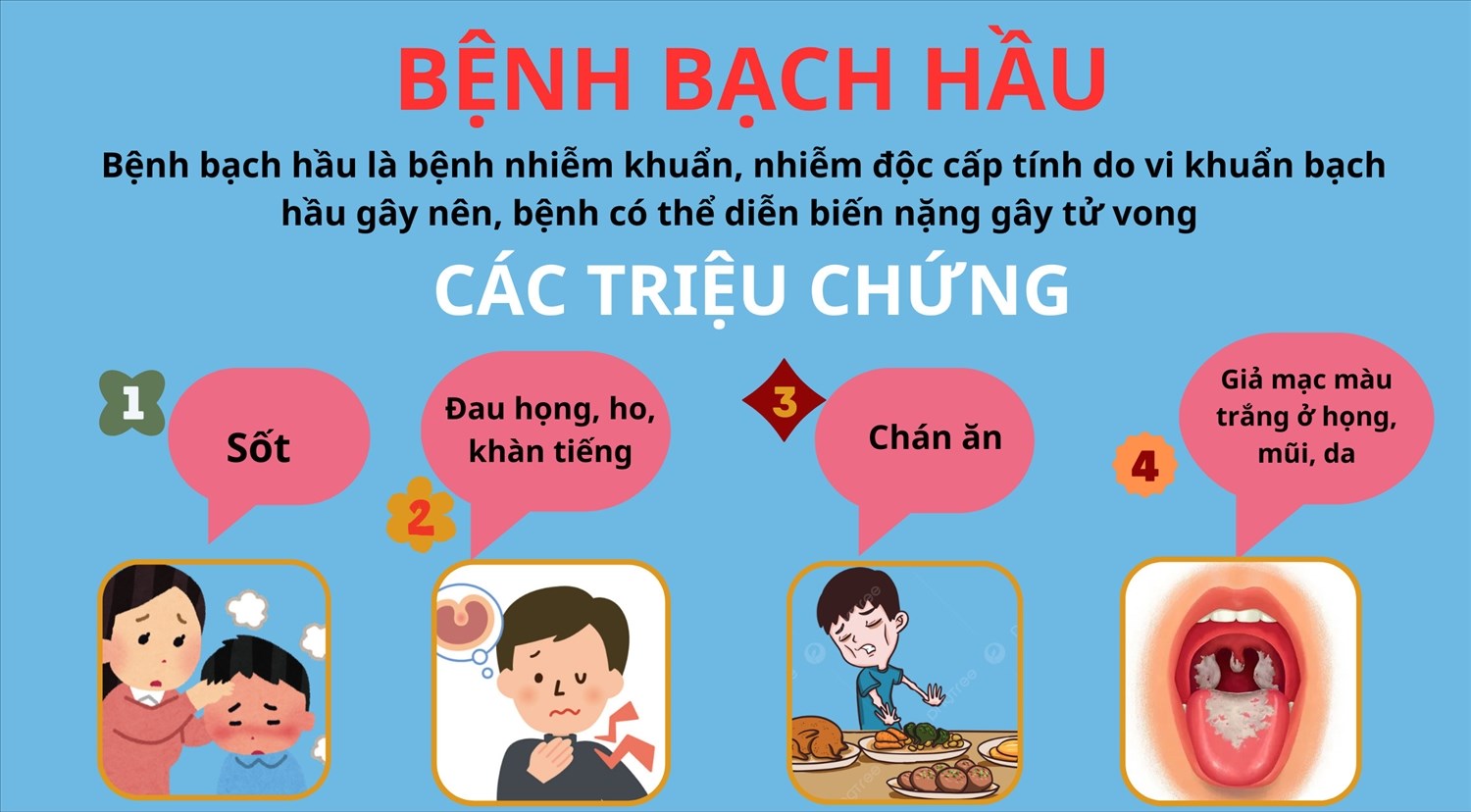 (Tổng hợp) Cách phòng, tránh bệnh bạch hầu tốt nhất 2