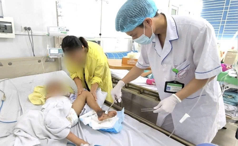 Việc tự ý đắp lá cây lên vết thương hở rất nguy hiểm, có thể gây nhiễm trùng và dẫn đến nhiều biến chứng nghiêm trọng
