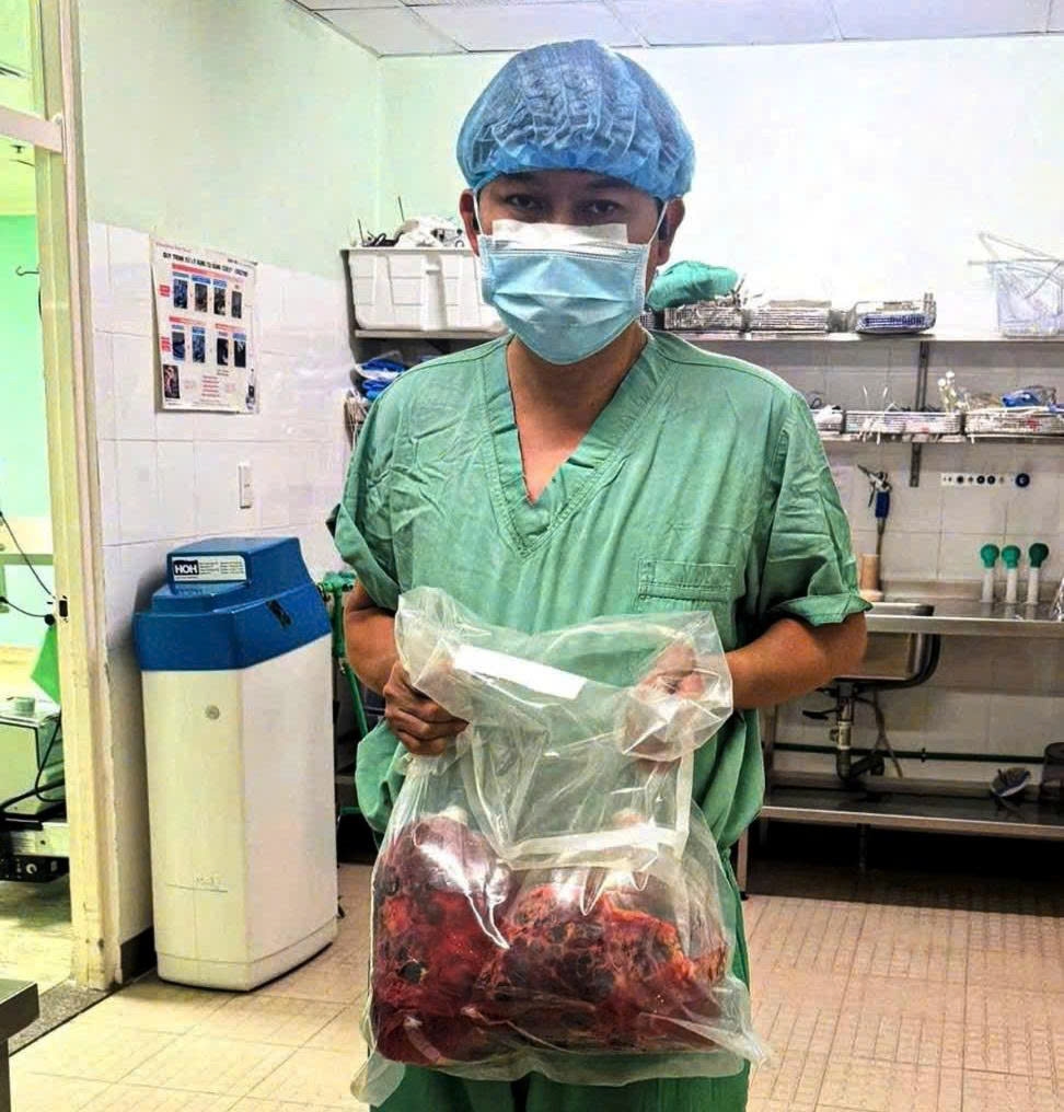 Hai quả thận đa nang nặng 10kg của bệnh nhân H.L (53 tuổi, trú TP Huế) được các Bác sỹ phẫu thuật cắt bỏ ra khỏi cơ thể. Ảnh: Điền Quang