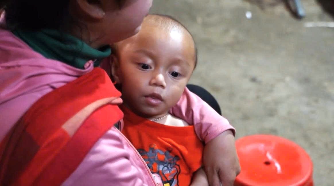 Hệ lụy của việc không sàng lọc trước sinh và sơ sinh để lại là rất lớn